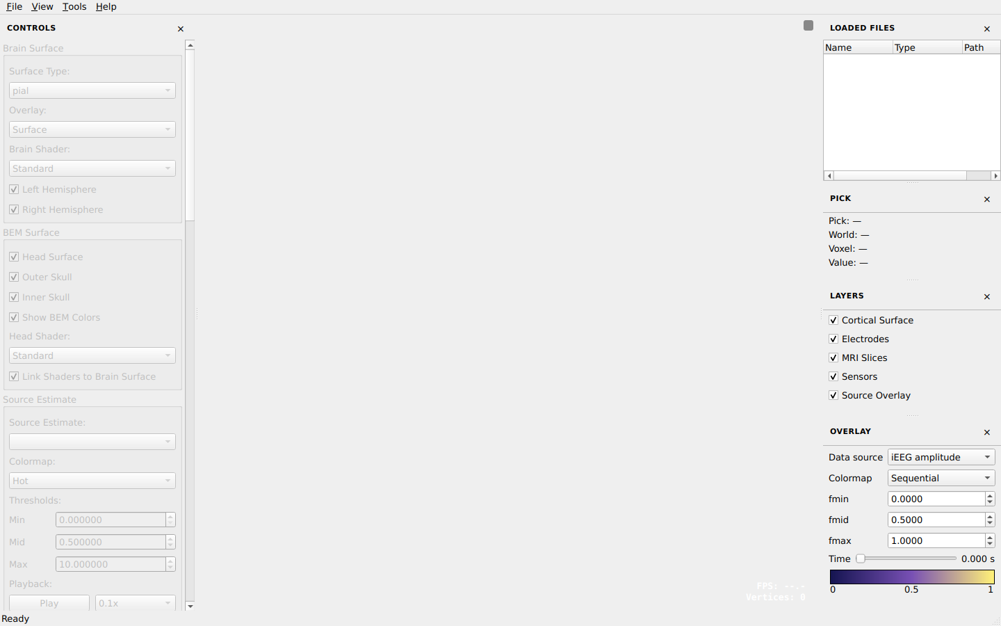 Load MRI dialog