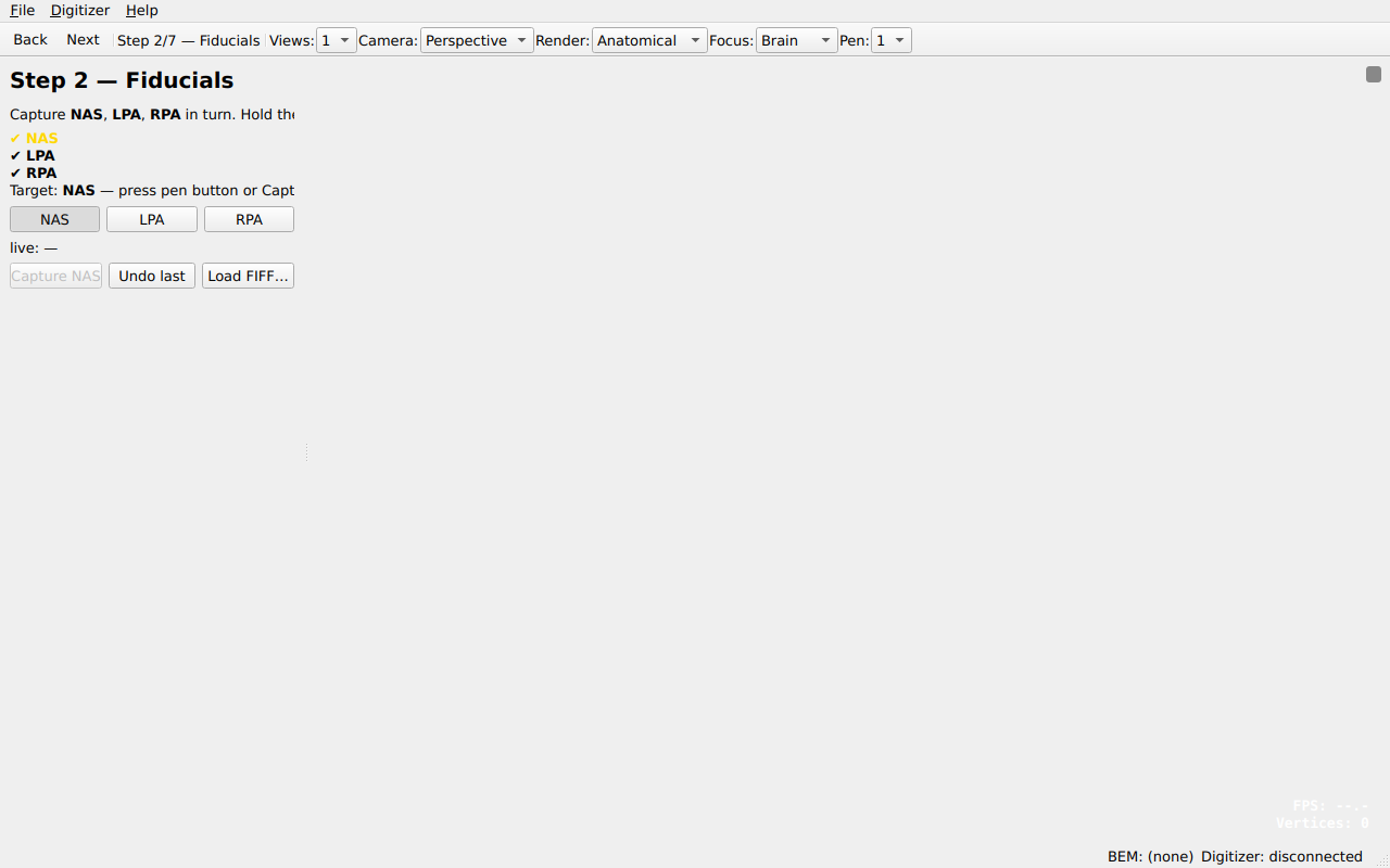 Step 2 — Fiducials