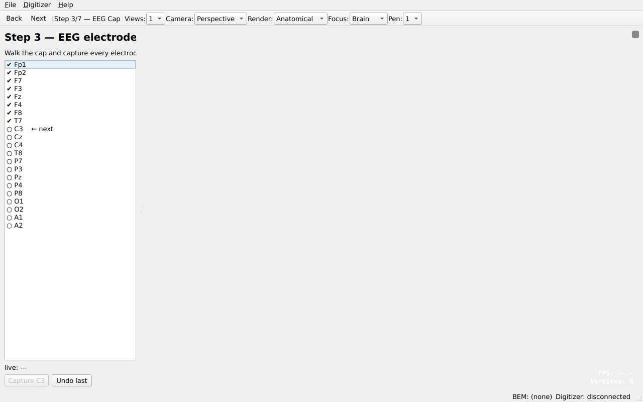 Step 3 — EEG cap